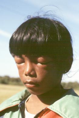 Portugal: Hiranti after being stung by bees